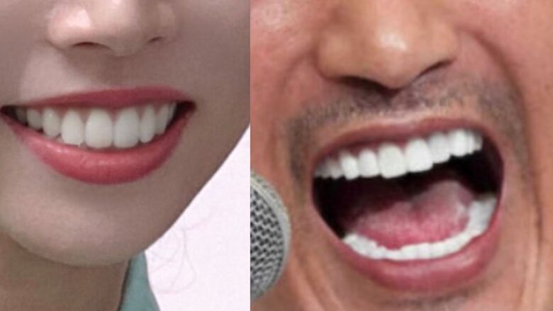 今井るるの歯(左)と新庄剛志の歯(右)の白さ比較